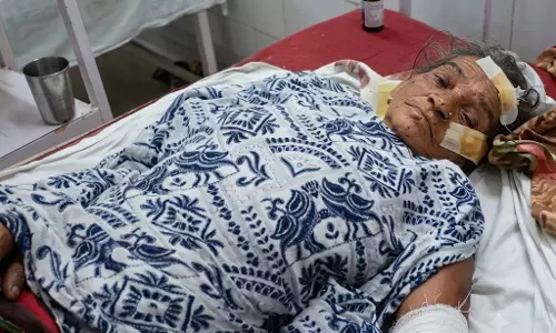 मौत को मात देकर लौटीं 65 वर्षीय महिला, भालू के हमले के बाद 2 किमी पैदल चलकर बचाई जान