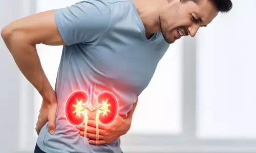 Kidney stones को लेकर 5 गलतफहमियां