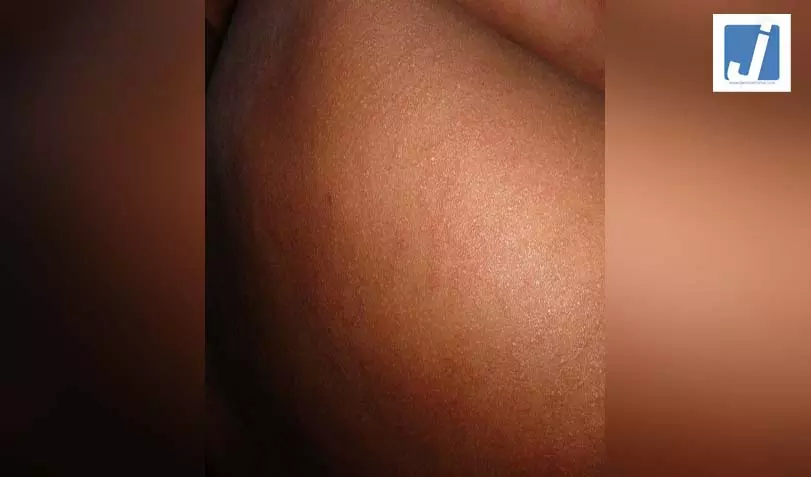 बांग्लादेश में खसरे का कहर जारी: 4 बच्चों ने तोड़ा दम, मृतकों की संख्या हुई 712 बांग्लादेश में खसरे का कहर जारी: 4 बच्चों ने तोड़ा दम, मृतकों की संख्या हुई 712