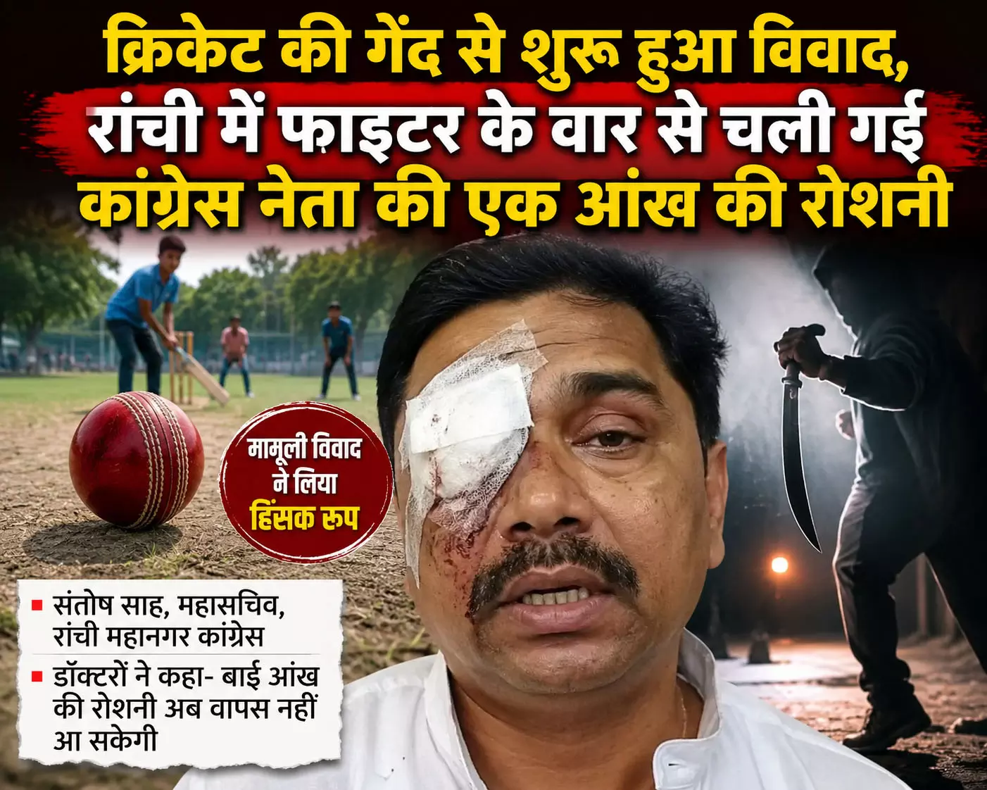 Ranchi : क्रिकेट विवाद ने लिया हिंसक रूप, कांग्रेस नेता संतोष साह की आंख की रोशनी गई Ranchi : क्रिकेट विवाद ने लिया हिंसक रूप, कांग्रेस नेता संतोष साह की आंख की रोशनी गई
