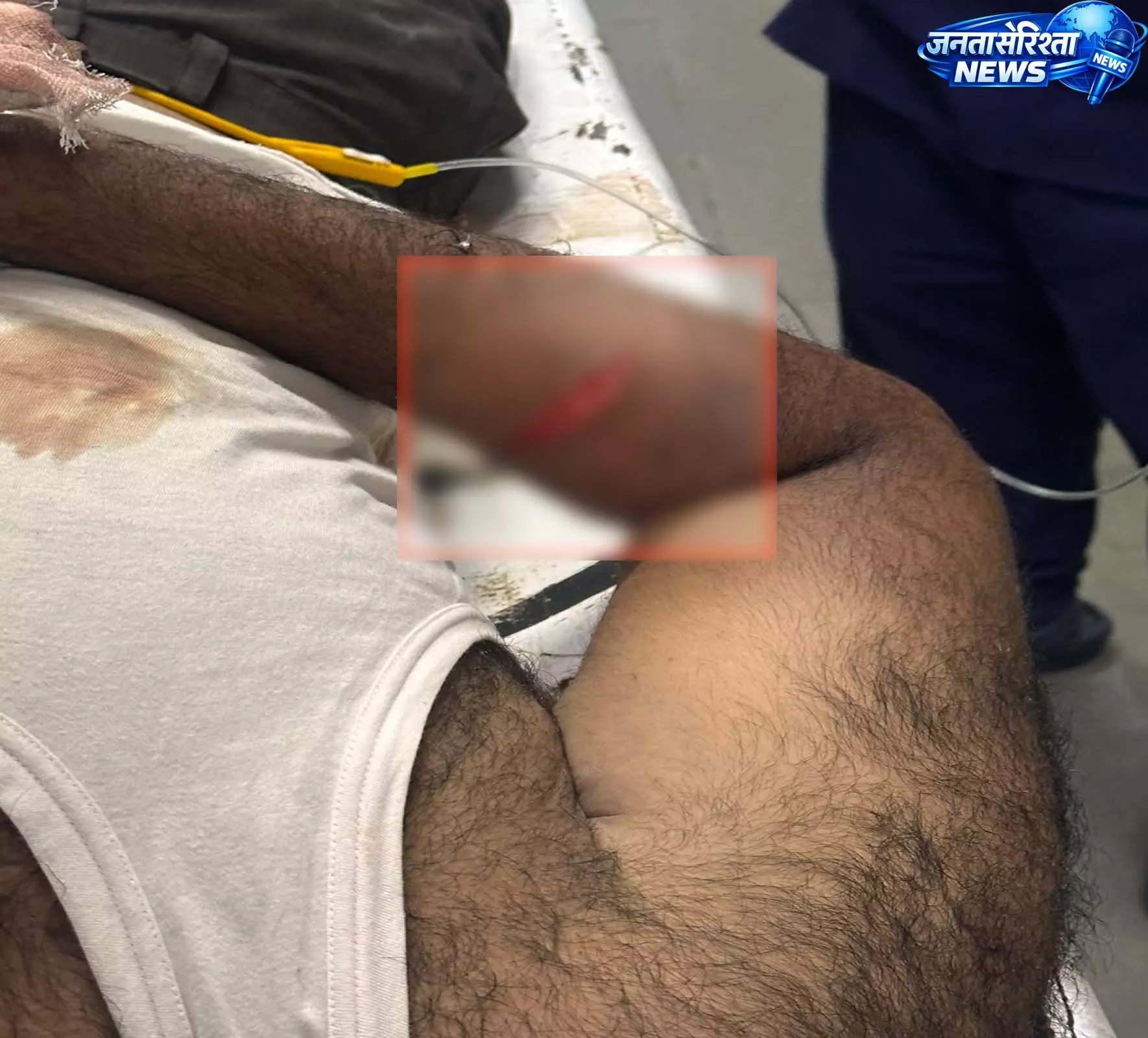 रायपुर के गंज थाना क्षेत्र में चाकूबाजी, पुरानी रंजिश में युवक घायल