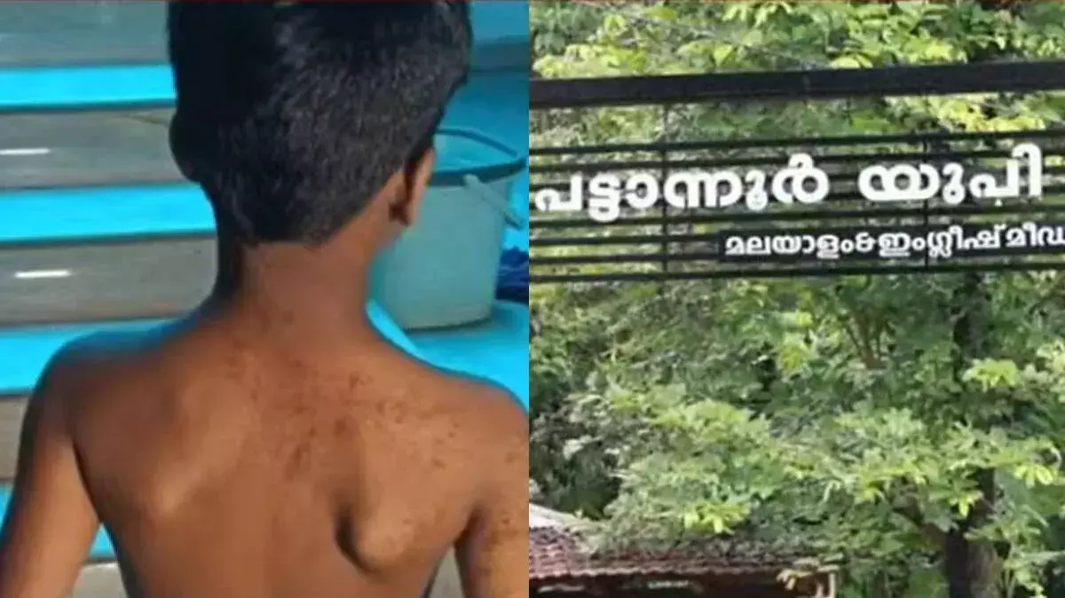 स्कूल में विवाद: कॉपी देरी पर नाबालिग पर हमला, टीचर पर केस