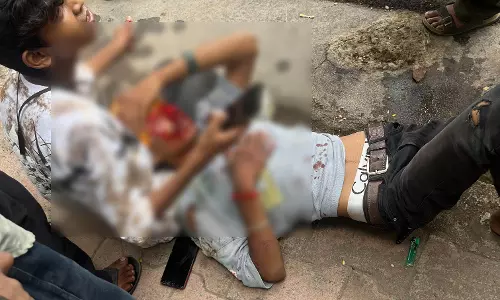 जीई रोड में कार ने पीछे से स्कूटी को मारी ठोकर, युवक का सिर फटा
