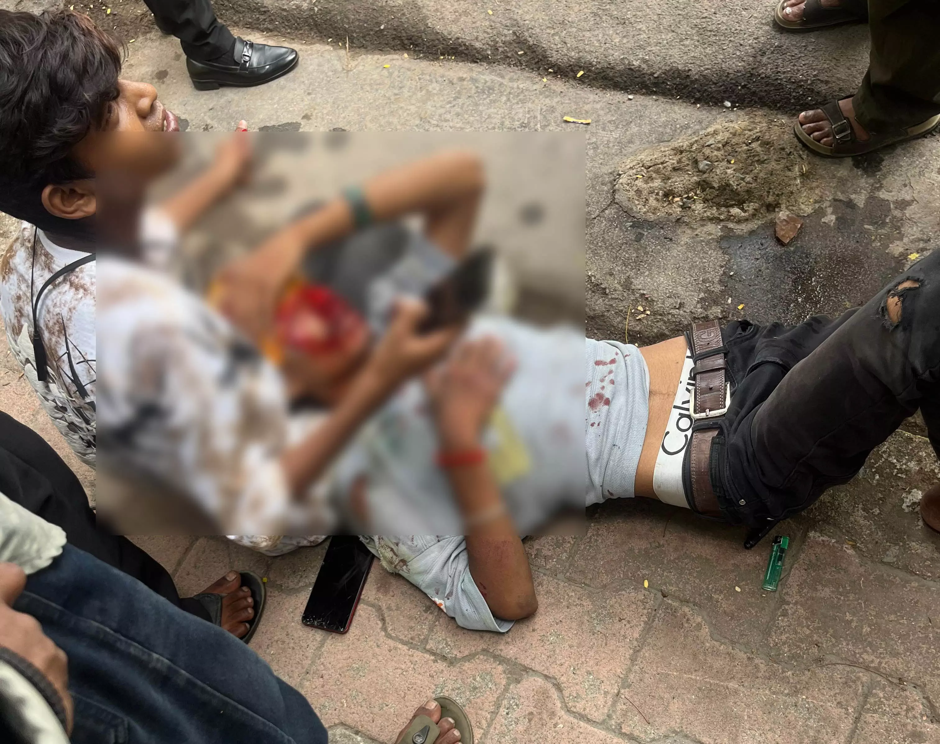 जीई रोड में कार ने पीछे से स्कूटी को मारी ठोकर, युवक का सिर फटा जीई रोड में कार ने पीछे से स्कूटी को मारी ठोकर, युवक का सिर फटा