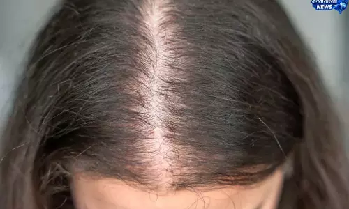 समय रहते पहचानें Hair थिनिंग के लक्षण समय रहते पहचानें Hair थिनिंग के लक्षण
