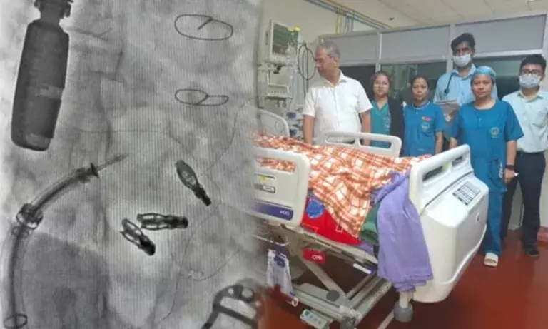 Meghalaya: NEIGRIHMS ने पूर्वी भारत का पहला ट्रांसकैथेटर ट्राइकसपिड वाल्व रिपेयर किया