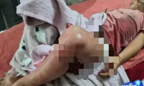 Manipur: कांगपोकपी के कुकी गांव पर सशस्त्र हमला, दो घायल, कई घरों में लगाई गई आग Manipur: कांगपोकपी के कुकी गांव पर सशस्त्र हमला, दो घायल, कई घरों में लगाई गई आग