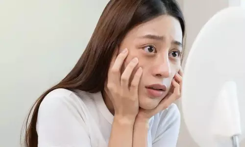 Dark circles से राहत का आसान तरीका, घर में बनाएं आई जेल Dark circles से राहत का आसान तरीका, घर में बनाएं आई जेल