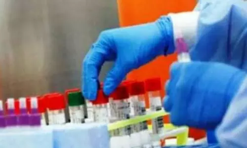 Hamirpur: स्वास्थ्य विभाग में भर्ती का मौका, 25 जुलाई तक आवेदन आमंत्रित Hamirpur: स्वास्थ्य विभाग में भर्ती का मौका, 25 जुलाई तक आवेदन आमंत्रित