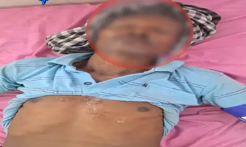 बिलासपुर में हाईटेंशन तार की चपेट में आए 5 मजदूर, मचा हड़कंप बिलासपुर में हाईटेंशन तार की चपेट में आए 5 मजदूर, मचा हड़कंप