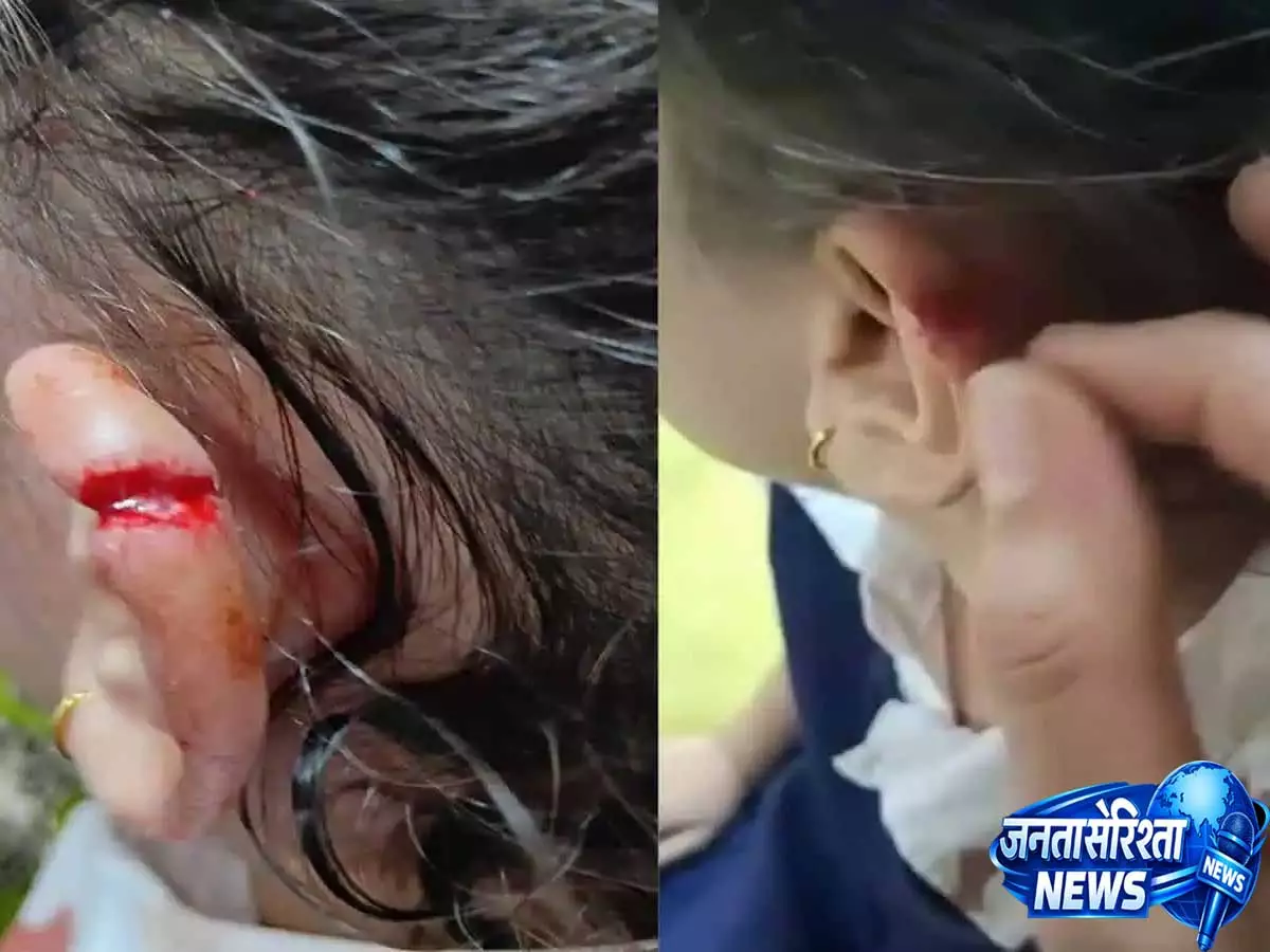 Hyderabad: शिक्षक की पिटाई से 4 वर्षीय छात्र घायल Hyderabad: शिक्षक की पिटाई से 4 वर्षीय छात्र घायल