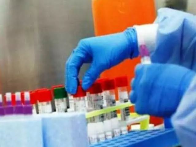 Hamirpur: स्वास्थ्य विभाग में भर्ती का मौका, 25 जुलाई तक आवेदन आमंत्रित