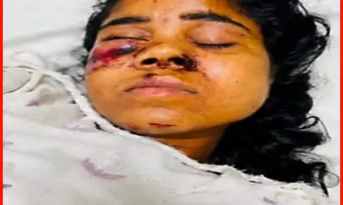 रेल हादसे में घायल मुंगेली की युवती सिम्स में भर्ती, परिजनों की तलाश जारी