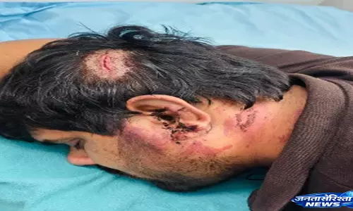 Kavi नगर में युवक से मारपीट, वायरल फुटेज के आधार पर पुलिस कार्रवाई Kavi नगर में युवक से मारपीट, वायरल फुटेज के आधार पर पुलिस कार्रवाई