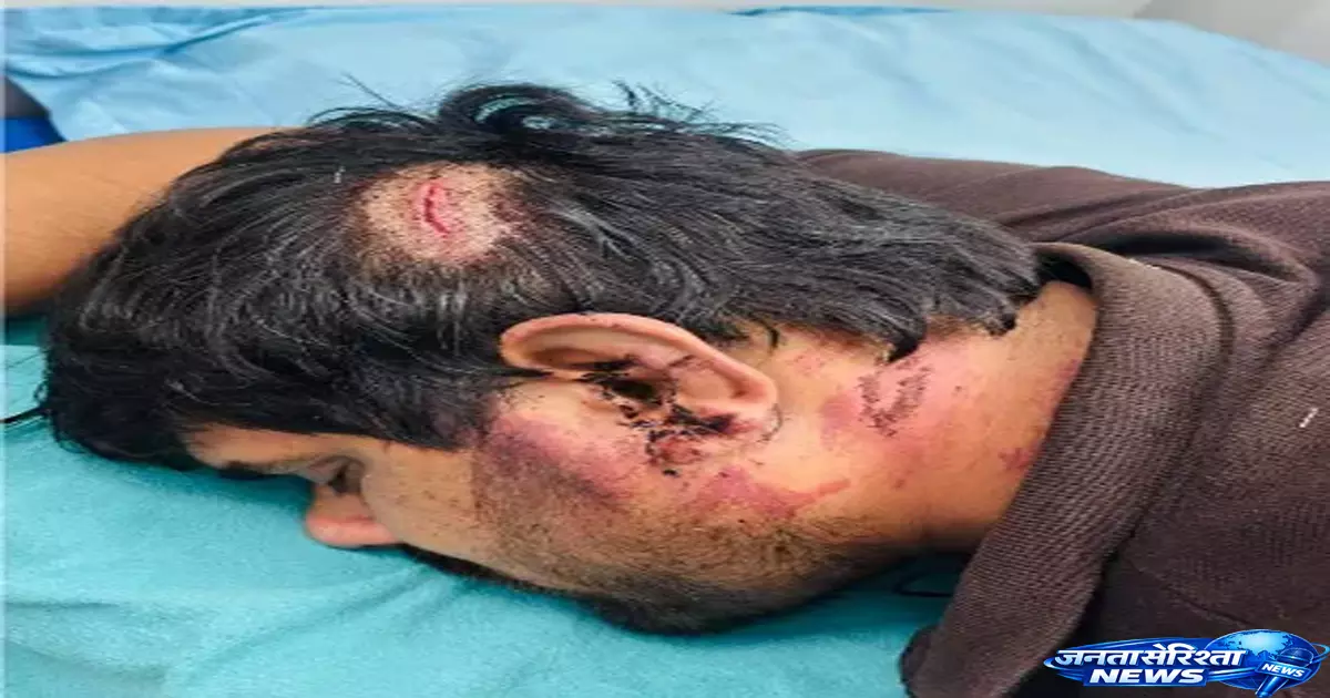Kavi नगर में युवक से मारपीट, वायरल फुटेज के आधार पर पुलिस कार्रवाई Kavi नगर में युवक से मारपीट, वायरल फुटेज के आधार पर पुलिस कार्रवाई
