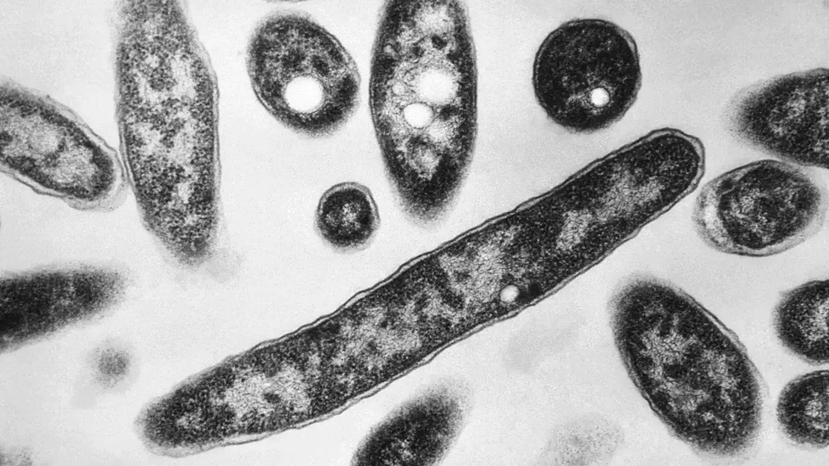 Legionnaires Disease: न्यूयॉर्क में बढ़ते मामलों के बीच जानें इस बैक्टीरियल संक्रमण के बारे में