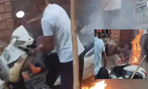 हाईटेंशन तार टूटकर सड़क पर गिरा, करंट से 5 झुलसे, स्कूटी में लगी आग हाईटेंशन तार टूटकर सड़क पर गिरा, करंट से 5 झुलसे, स्कूटी में लगी आग