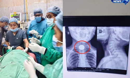 6 साल के मासूम के गले में फसा सिक्का, डॉक्टरों ने बचाई जान 6 साल के मासूम के गले में फसा सिक्का, डॉक्टरों ने बचाई जान
