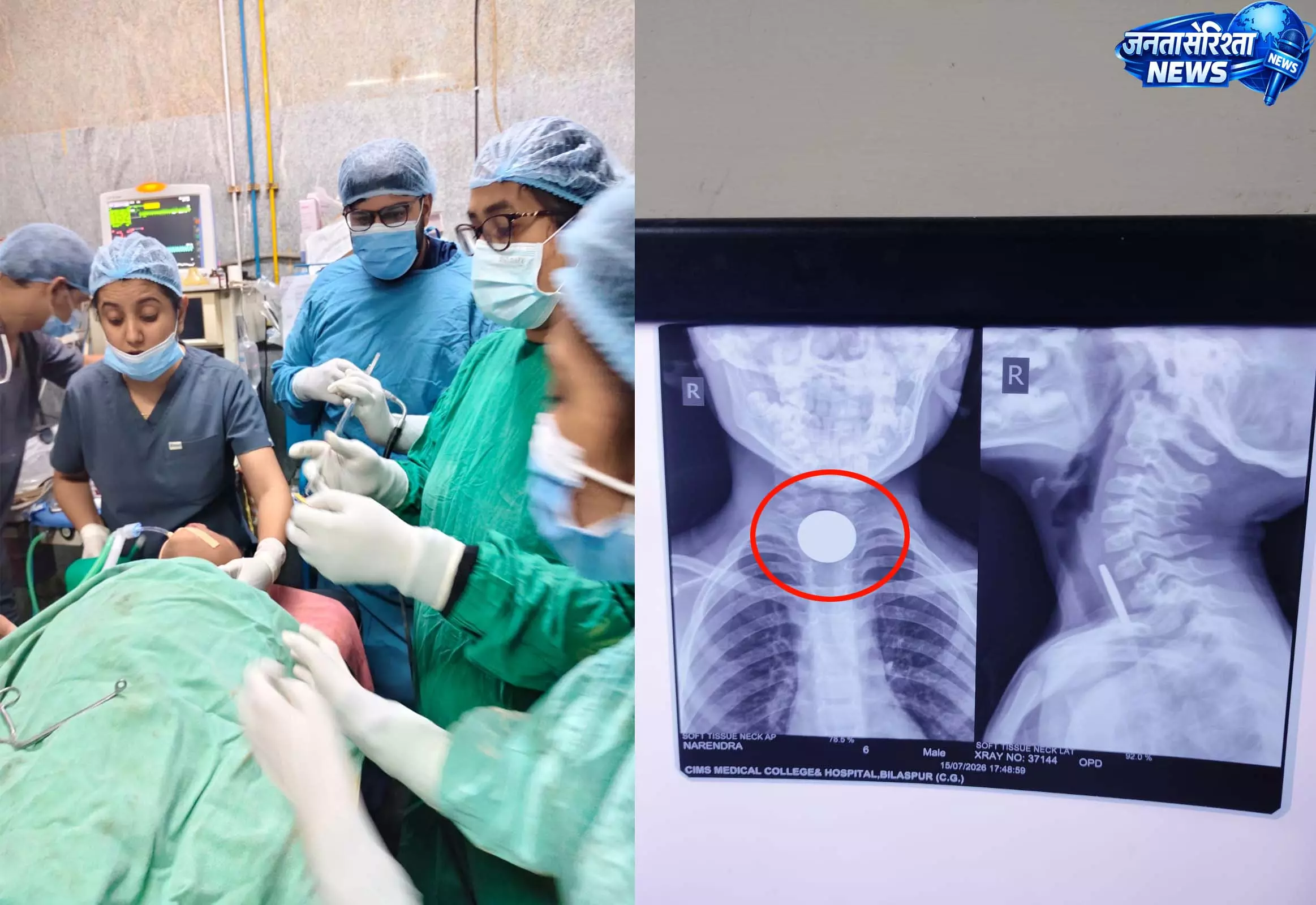 6 साल के मासूम के गले में फसा सिक्का, डॉक्टरों ने बचाई जान 6 साल के मासूम के गले में फसा सिक्का, डॉक्टरों ने बचाई जान
