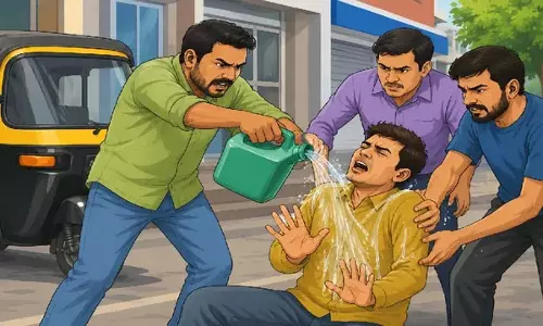 ऑटो चालक को जिंदा जलाने का आरोप, रिम्स में गंभीर हालत में भर्ती ऑटो चालक को जिंदा जलाने का आरोप, रिम्स में गंभीर हालत में भर्ती