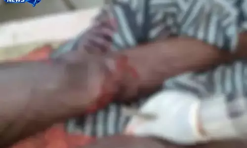 CG: घर के पास भालू ने ग्रामीण पर किया हमला, जान बचाने भिड़ा युवक CG: घर के पास भालू ने ग्रामीण पर किया हमला, जान बचाने भिड़ा युवक