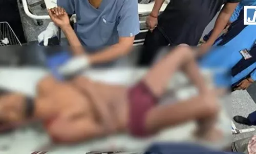मौत को दी मात...मजदूर के शरीर में आर-पार धंसी थी चार लोहे की सरिया मौत को दी मात...मजदूर के शरीर में आर-पार धंसी थी चार लोहे की सरिया