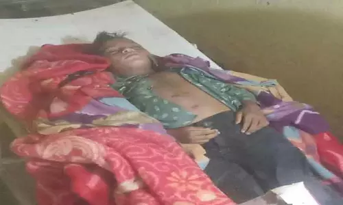 CG BREAKING: आकाशीय बिजली का कहर, दो सगे भाई झुलसे CG BREAKING: आकाशीय बिजली का कहर, दो सगे भाई झुलसे