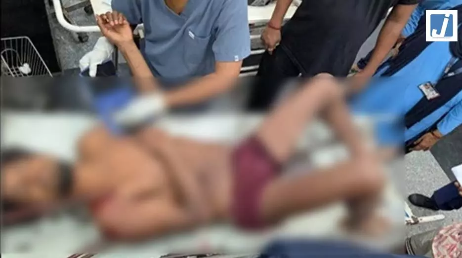 मौत को दी मात...मजदूर के शरीर में आर-पार धंसी थी चार लोहे की सरिया मौत को दी मात...मजदूर के शरीर में आर-पार धंसी थी चार लोहे की सरिया