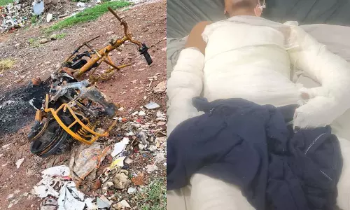 कोटा में युवक को पेट्रोल डालकर जिंदा जलाने का परिजनों ने लगाया आरोप कोटा में युवक को पेट्रोल डालकर जिंदा जलाने का परिजनों ने लगाया आरोप