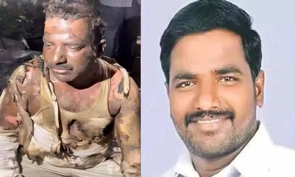 Telangana: वारंगल में कांग्रेस नेता की हत्या की कोशिश; पीड़ित ने पेट्रोल से हमले का आरोप लगाया Telangana: वारंगल में कांग्रेस नेता की हत्या की कोशिश; पीड़ित ने पेट्रोल से हमले का आरोप लगाया