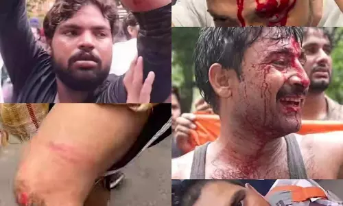 सिर फटने से लेकर चोटों के दावे तक! दिल्ली प्रदर्शन पर गरमाई राजनीति, तस्वीरें सामने