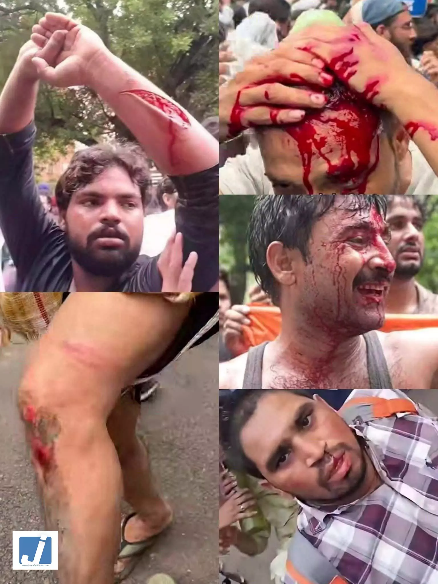 सिर फटने से लेकर चोटों के दावे तक! दिल्ली प्रदर्शन पर गरमाई राजनीति, तस्वीरें सामने सिर फटने से लेकर चोटों के दावे तक! दिल्ली प्रदर्शन पर गरमाई राजनीति, तस्वीरें सामने