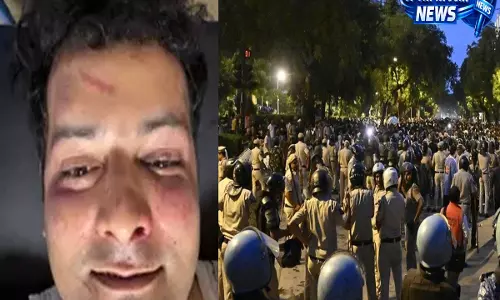 एसीपी विवेक भगत का बड़ा खुलासा: भीड़ ने पुलिसकर्मियों को चुन-चुनकर बनाया निशाना एसीपी विवेक भगत का बड़ा खुलासा: भीड़ ने पुलिसकर्मियों को चुन-चुनकर बनाया निशाना