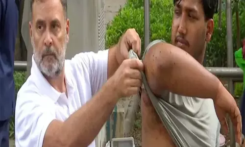 घायल छात्रों के समर्थन में उतरे राहुल, सरकार से मांगा जवाब घायल छात्रों के समर्थन में उतरे राहुल, सरकार से मांगा जवाब