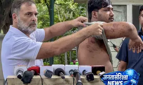 Delhi पैलेट गन पीड़ित छात्र को लेकर राहुल का सवाल Delhi पैलेट गन पीड़ित छात्र को लेकर राहुल का सवाल