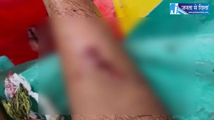 बंदरों ने दर्जनभर लोगों पर किया हमला, दहशत का माहौल बंदरों ने दर्जनभर लोगों पर किया हमला, दहशत का माहौल