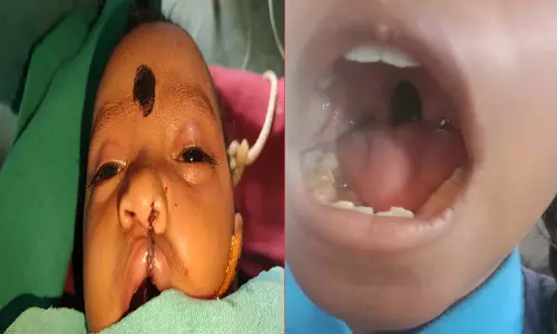 चिरायु ने बदली मासूमों की ज़िंदगी, मिला सामान्य जीवन