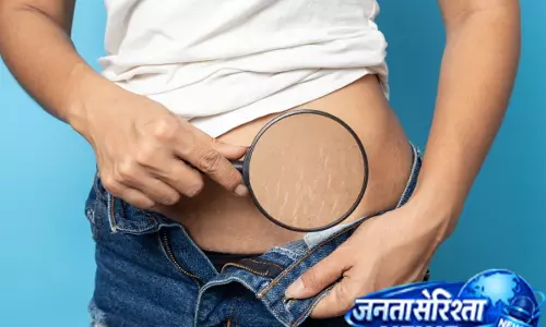 डिलीवरी के बाद स्ट्रेच मार्क्स की चिंता खत्म, आजमाएं ये नुस्खा