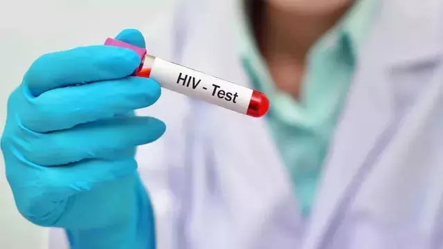 HIV संक्रमित मरीजों को मिलेगी लंबित पेंशन राशि, 2.72 करोड़ का बजट जारी HIV संक्रमित मरीजों को मिलेगी लंबित पेंशन राशि, 2.72 करोड़ का बजट जारी
