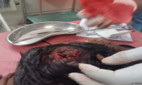 रायगढ़ में बंदरों ने कई लोगों को काटा, हाथियों के झुंड ने किया सड़क जाम रायगढ़ में बंदरों ने कई लोगों को काटा, हाथियों के झुंड ने किया सड़क जाम