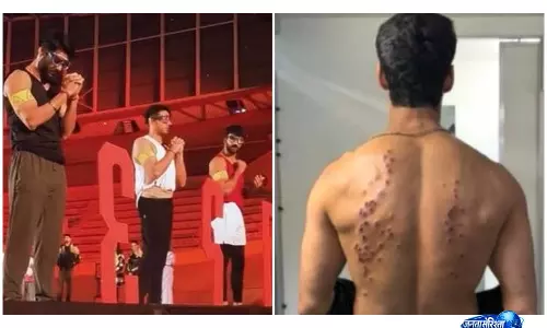 KKK 15 में करण वाही ने दिखाए रबर बुलेट चैलेंज के निशान, सीजन को बताया सबसे डरावना KKK 15 में करण वाही ने दिखाए रबर बुलेट चैलेंज के निशान, सीजन को बताया सबसे डरावना