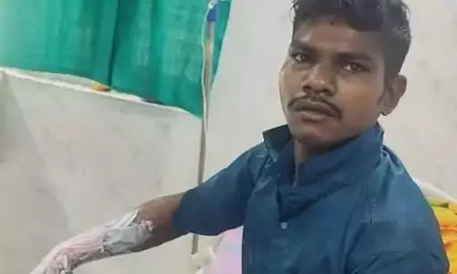 पत्नी पर कमेंट से भड़का दोस्त, पेट्रोल डालकर जिंदा जलाने की कोशिश पत्नी पर कमेंट से भड़का दोस्त, पेट्रोल डालकर जिंदा जलाने की कोशिश