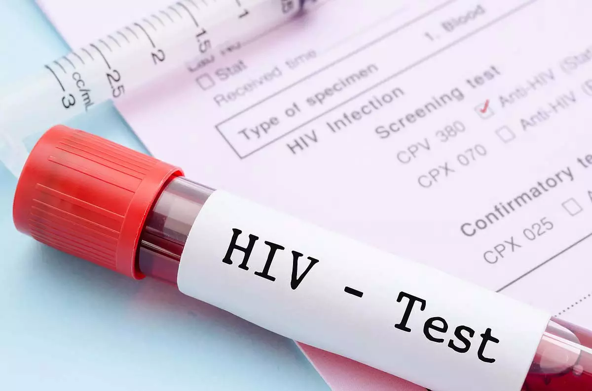 नाम उजागर होने से HIV संक्रमितों में आक्रोश नाम उजागर होने से HIV संक्रमितों में आक्रोश