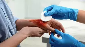 मेडिकल क्षेत्र में बड़ी बढ़त: CSIR-IICT का सर्जिकल एडहेसिव मिशन मेडिकल क्षेत्र में बड़ी बढ़त: CSIR-IICT का सर्जिकल एडहेसिव मिशन