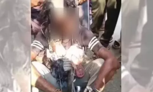 उन्नाव में मोबाइल चोरी के आरोप में युवक को तालिबानी सजा