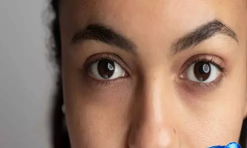 आंखों के नीचे काले घेरे होंगे कम रोज अपनाएं ये 9 टिप्स आंखों के नीचे काले घेरे होंगे कम रोज अपनाएं ये 9 टिप्स