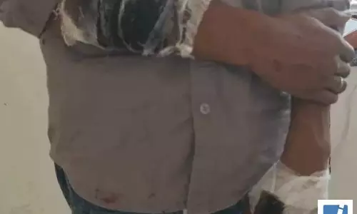 PT टीचर पर छात्रा को परेशान करने का आरोप, भाई की पिटाई भी कराई