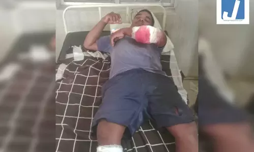 CG: भालुओं का आतंक, ग्रामीणों पर किया हमला, दो की हालत गंभीर CG: भालुओं का आतंक, ग्रामीणों पर किया हमला, दो की हालत गंभीर
