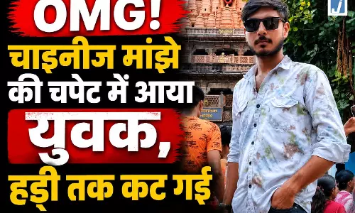 OMG! चाइनीज मांझे की चपेट में आया युवक, हड्डी तक कट गई