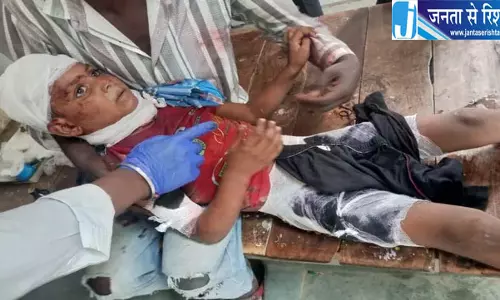 जौनपुर में आवारा कुत्तों के झुंड ने 8 वर्षीय बच्चे पर किया हमला हालत गंभीर